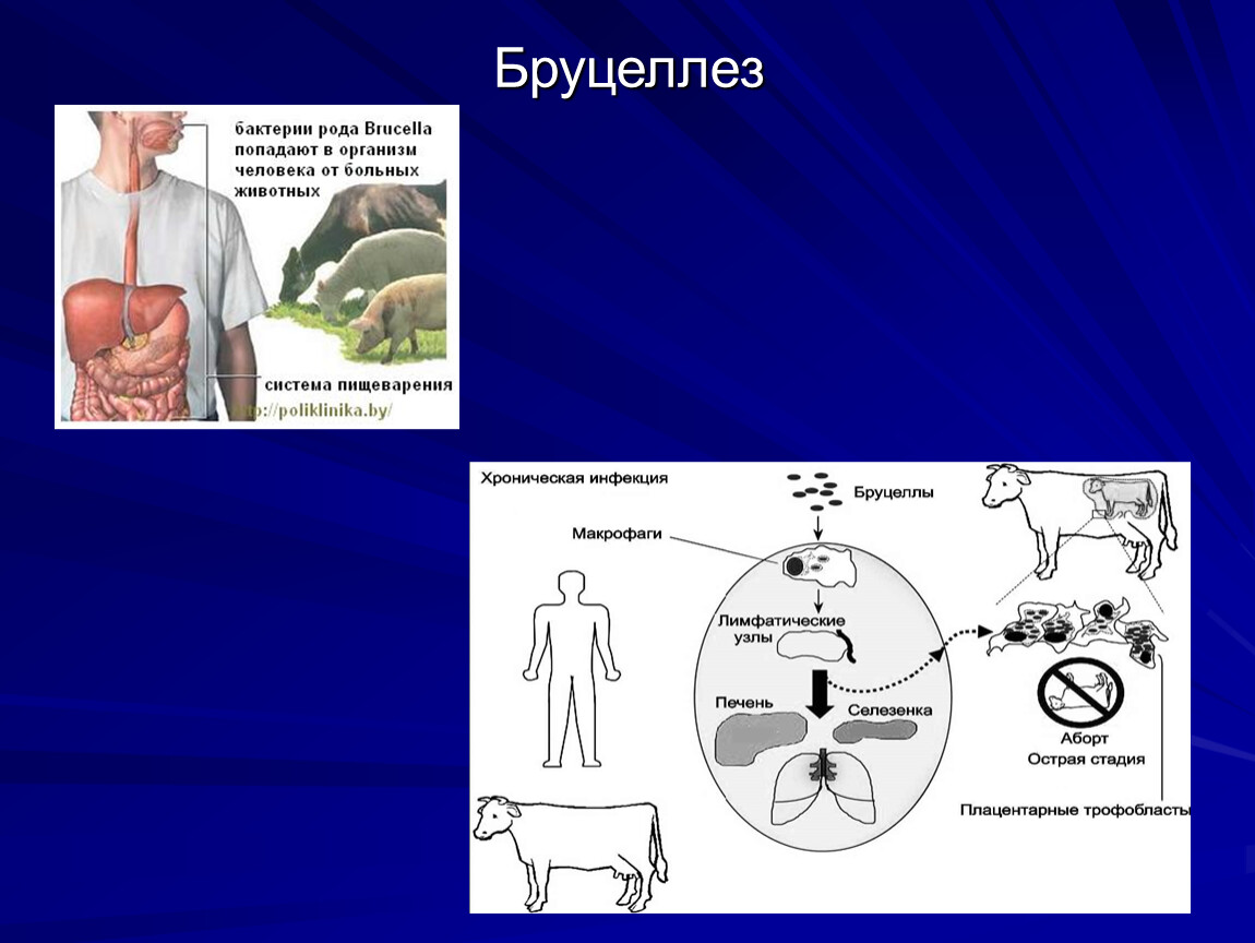 Бруцеллез презентация